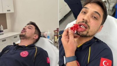 Bursa'da çevre yolu üzerinde meydana gelen olayda kalp krizi geçiren