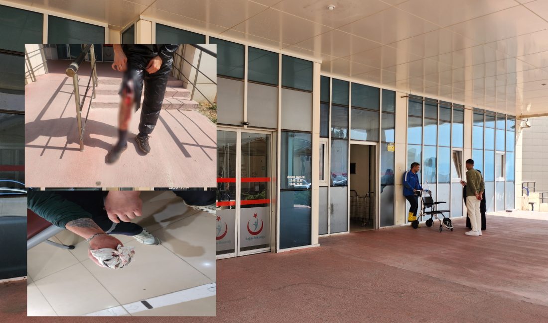 Bursa'da Kurban Bayramı'nın ilk gününde  kasapların  kendini kesme