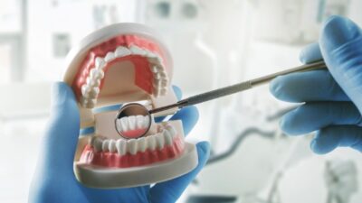 Yetersiz ağız hijyeninin diş çürükleri ve diş eti hastalıklarının yanı